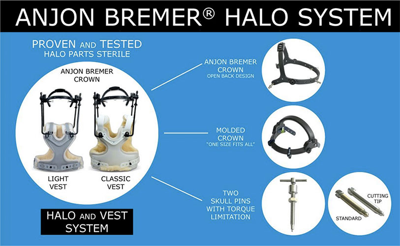 Bremer Halo